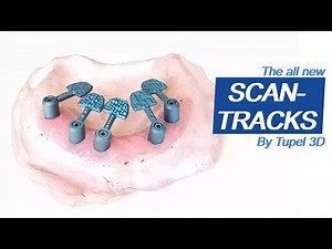 The new Tupel 3D Scan-Tracks