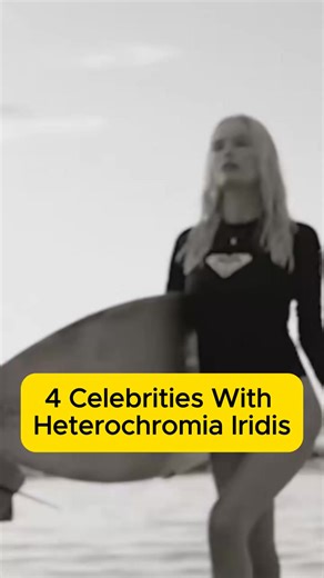 4 Celebrities With Heterochromia Iridis #celebrities #celebrity #movi... | Cat in the Bosom