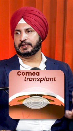 When corneal damage affects daily vision, a cornea transplant can help restore clarity. This video explains when it’s needed and what recovery usually looks like. [Cornea transplant, corneal damage treatment, vision restoration, eye surgery, eye specialist, best eye hospital, eye care treatment, cornea surgery India] . . #CorneaTransplant #EyeCare #VisionRestoration #EyeHealth | Dr. Mandeep Basu