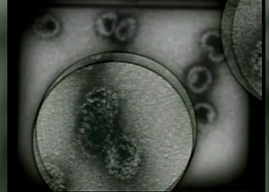 Doctors emphasize cervical cancer prevention through early screening and vaccination