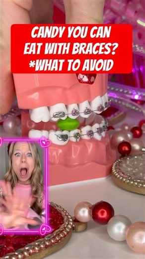 CANDY YOU CAN EAT WITH BRACES? 🧐 #braces #candy #foodasmr