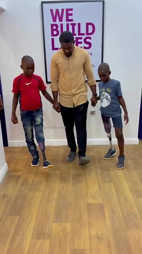 Pediatric Prosthetics: Empowering Kids to Move Freely