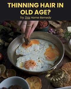 Many people suffer from hair loss.. Is it possible to regrow it somehow? | Lifestyle News