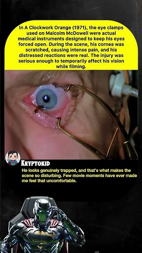 In A Clockwork Orange (1971), the eye clampsused on Malcolm McDowell were actualmedica