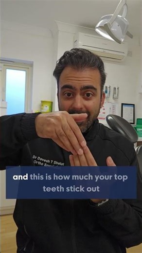 What Is an Overbite / Overjet?