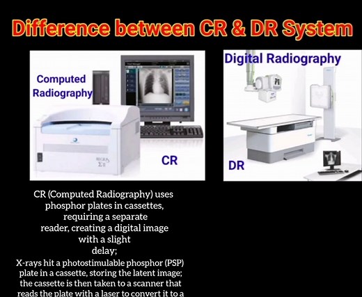 Understanding Computed vs Digital Radiography Systems