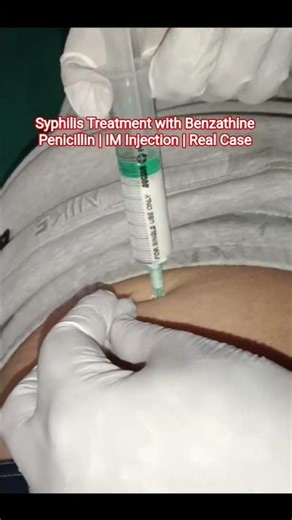 Syphilis Management: Bilateral Buttocks IM Injection | Medicos Factz