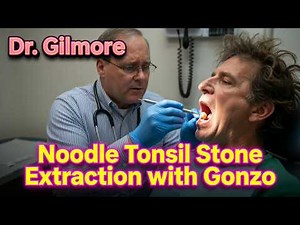 Noodle Tonsil Stone Extraction with Gonzo