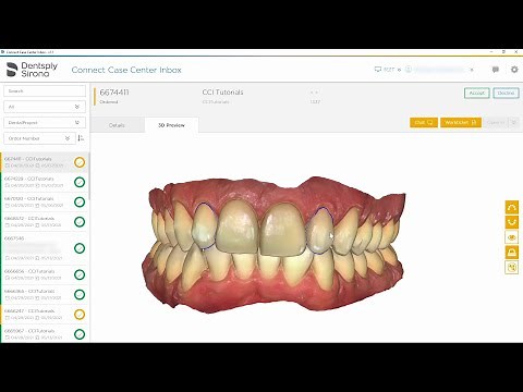 Tutorial - Connect Case Center Inbox to 3Shape: Veneer PLY Format