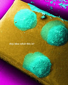 👨🏻‍🦯Recognizing World Braille Day! 🌍 Today, we take a closer look at Braille, a vital tool for accessibility and communication for visually impaired people. Look at the details of the Braille dots on a medicine packaging. The dots have been cut out of the packaging, sputtered, imaged under an electron microscope and colored afterwards. This procedure makes them look more like works of art than simple pieces of cardboard. Let’s celebrate both the practicality and artistry of Braille in promot