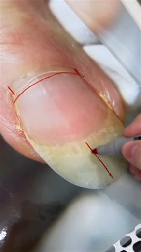 Online education for nail techs on Instagram: "High quality tools are a basis and a guarantee for a clean manicure and pedicure! That’s why our MOZHZHERI instructors work with our MOZHZHERI tools! You invest in your own success! But MOZHZHERI instructors have discounts and free instruments for students 👀 Dive into international online instructor courses at MOZHZHERI School. Choose from THREE enticing options: 1. Basic with online meetings 💻 2. Combined manicure technique with teaching rights �