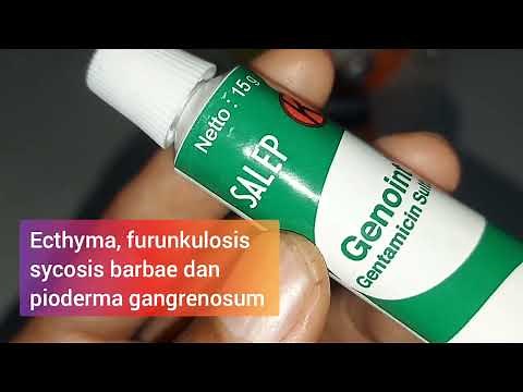 Salep Kulit Gentamicin Genoint | Antimikroba | Bakterisida | Infeksi Kulit | Luka bernanah | Bakteri