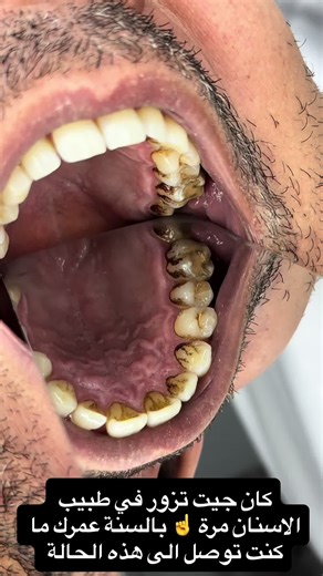 أفضل نصائح العناية بالأسنان مع الدكتورة صفاء حبيبي