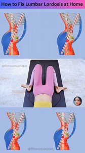 Straightening of Lumbar Lordosis || How to fix Lumbar Lordosis #lumbar #straightening #LumbarLordosis #howto #fbviral #instareels #viralreelsfacebook #viralinstagramreels | Fitness Mantram