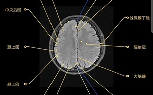 超详细脑部MRI断层分析逐帧播放‖医学生果断收藏~
