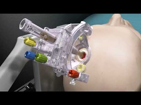 ClearPoint Demonstration Video