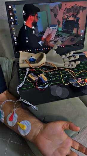 🔥 s.click.aliexpress.com/e/_EzIWqH6 EMG Controlled Robotic Arm For Arduino EMG Sensor Diy Kit School Science STEM Education Physics Teaching #robot #robotics #roboticarm #arduino | Ebokify