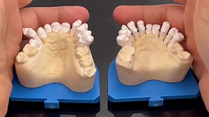 20 Feldspathic Veneers on Refractory! Sunday “One Bake” Upper and Lower Simultaneously layering….. | Nondas Vlachopoulos