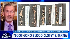 "Foot-Long Blood Clots" From mRNA, Says Pathologist Dr. Ryan Cole w/ Dr Kelly Victory – Ask Dr. Drew