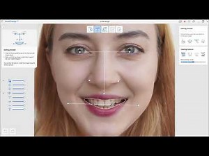 口腔内スキャナー Medit アプリ「Smile Dsign」の使い方