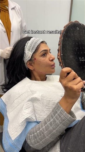 ✨ Lift, Firm, and Rejuvenate with Thread Lift! ✨