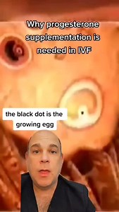 33K views · 139 reactions | Why progesterone supplements are needed in IVF to prevent miscarriage and achieve pregnancy #progesterone #miscarriage #pregnancy #infertility #IVF #ttc #infertilitywarrior #ivfwarrior #infertilityjourney #Reels #reelsvideo #reelsviral #reelinstagram | Steven Palter | Facebook