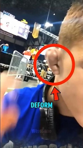 TRUTH ABOUT CAULIFLOWER EAR! 😱