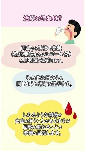 Bスポット療法について✨