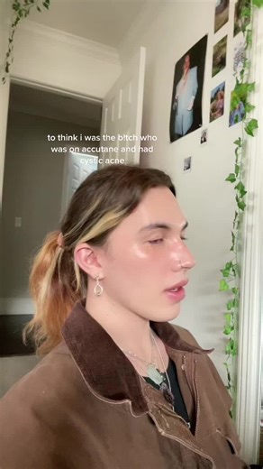 Cystic Acne Reflection: My Accutane Journey