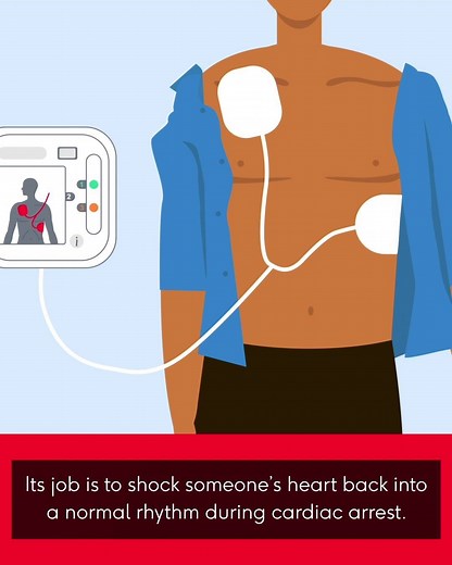 8.9K views · 261 reactions | Using a defibrillator with CPR can more than double the chance of surviving an out of hospital cardiac arrest. Has your community got a defibrillator? | British Heart Foundation | Facebook