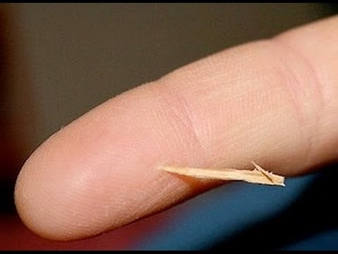 Easiest Way to Remove a Splinter - Life Hack