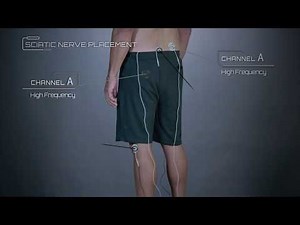 Radiating Leg Pain Placement Example