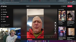 xqc吃惊老哥表演头骨凹陷复原术_哔哩哔哩_bilibili