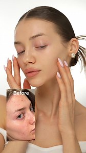Gentle power for your delicate skin 🌿✨🤍 No fragrance, no alcohol, just pure botanical goodness to keep your skin calm and resilient. Hypoallergenic & Vegan ✔️ Restores skin’s natural balance ✔️ Fast absorption with no stickiness ✔️ Because sensitive skin deserves a routine that’s both kind and effective. Live with wonder, day by day 🤍 · Black Rice Hyaluronic Toner | Gentle hydration for sensitive skin · Black Rice Probiotics Barrier Essence | Probiotics for a balanced skin microbiome #haruhar