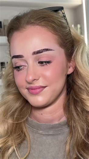 Browlifting of the Day: Browlift Before & After Tips