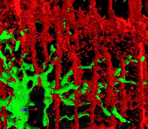 File:Adaptive-Müller-cell-responses-to-microglial-activation-mediate-neuroprotection-and-coordinate-1742-2094-8-173-S1.ogv - Wikimedia Commons