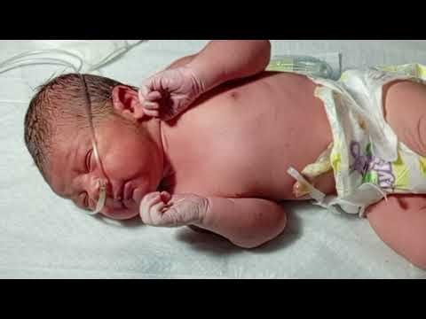 Episode ( 1 )NICU Cleaning & Passing I/V Line in Newborn Baby | Step-by-Step Neonatal Care