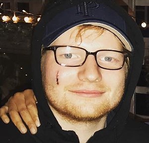 Princess Beatrice accidentally slashed Ed Sheeran with a sword