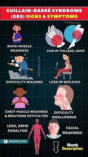 Guillain Barré Syndrome: What Causes Sudden Muscle Weakness & Paralysis?