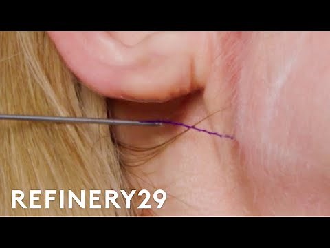 I Got A Thread Injection Facelift | Macro Beauty | Refinery29