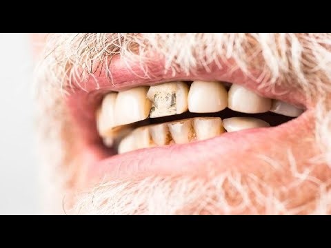 Scientists Find Stem Cells That Could Regrow Human Teeth and Bone!