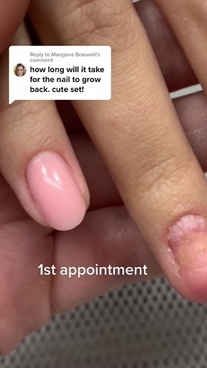 Nail Growth Transformation: Tips and Tricks