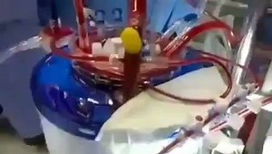 8.4K views · 174 reactions | La circulation extracorporelle: elle consiste à remplacer temporairement les fonctions des organes vitaux d'un patient, tels que le cœur et les poumons, lorsqu'ils sont inopérants lors d'une chirurgie cardiaque complexe, par exemple. (source : estudante_em_foco) | Etudiants en Santé | Facebook