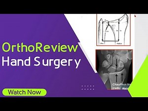 OrthoReview - Hand Surgery