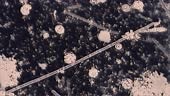 Bacterias and bacillus are magnified under the microscope and filmed...