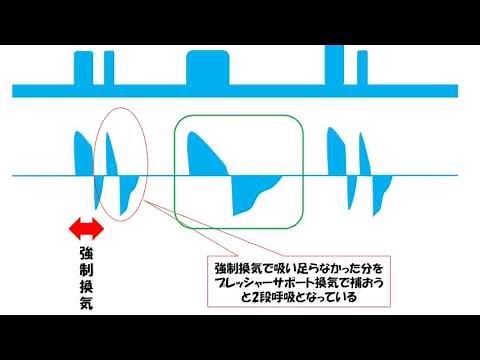 グラフィックを用いた設定変更
