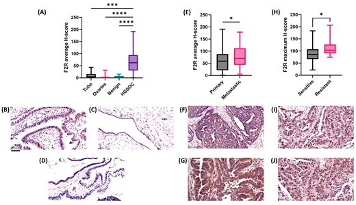 Scientists uncover new driver of ovarian cancer spread