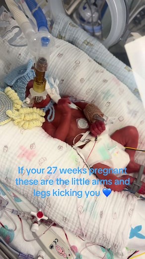 Understanding 27-Week Premature Baby Development
