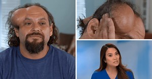 'Dr Pimple Popper' Season 9: Dr Lee's new patient Robert worries his wife will leave him due to head lump