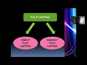 Indirect pulp capping | Endodontics | Dr Deepti | SBDCH
